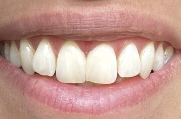 Springhill Dental